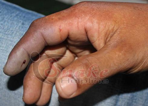 viper bite